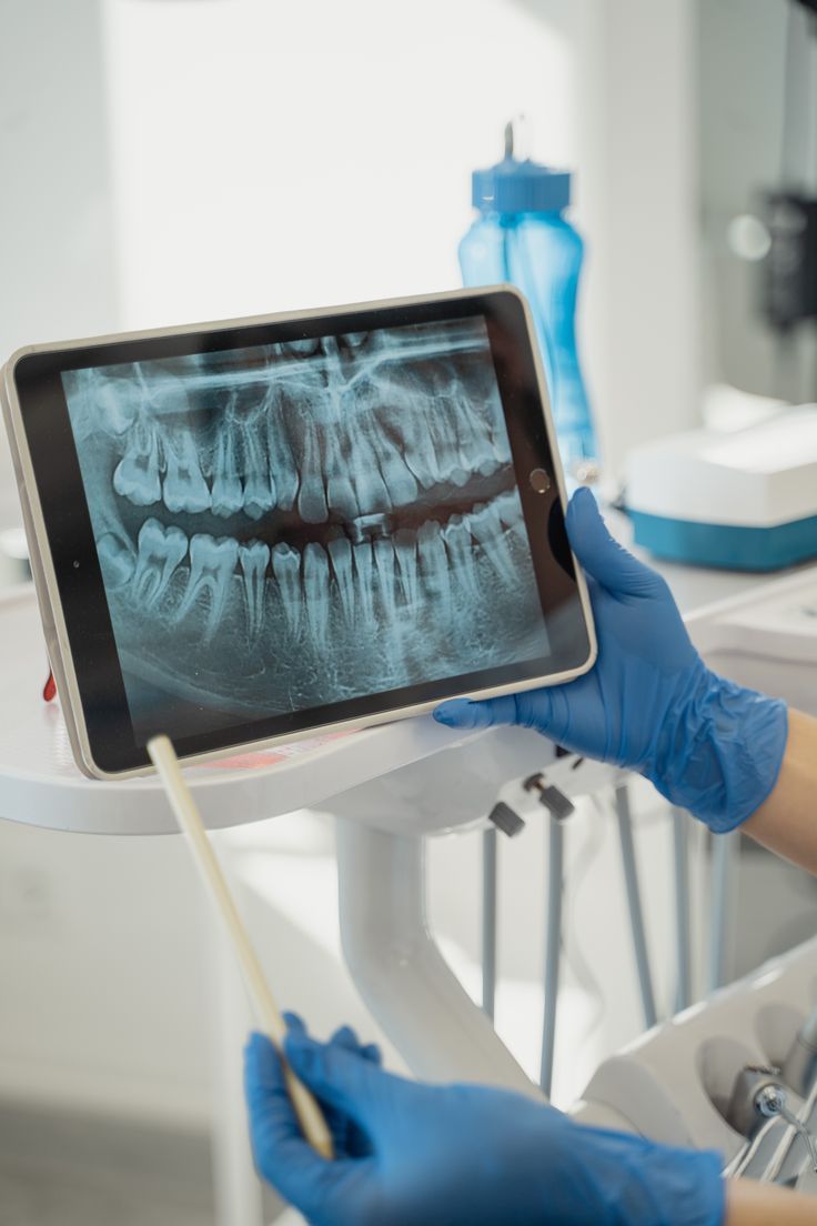 Diagnóstico dental por imágenes